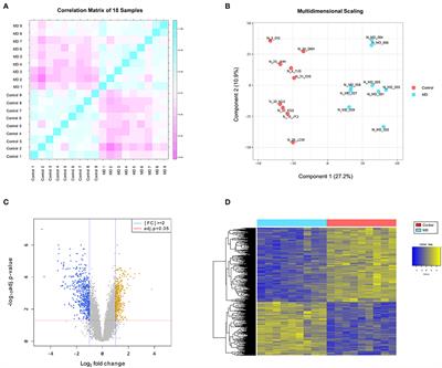 Transcriptional Down-Regulation of Major Histocompatibility Complex as a Possible Pathogenesis for Meniere's Disease